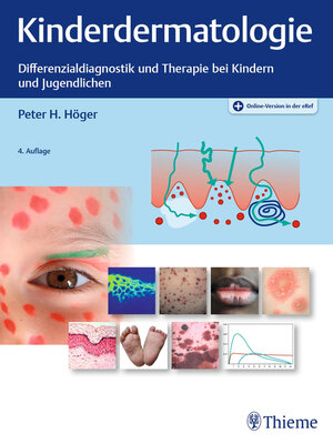 cover image of Kinderdermatologie